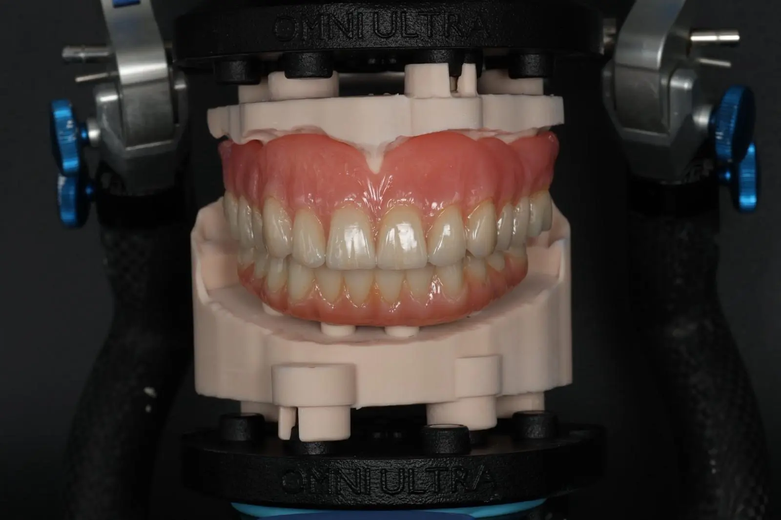 Full denture mounted on DACOS Omni Ultra, front view