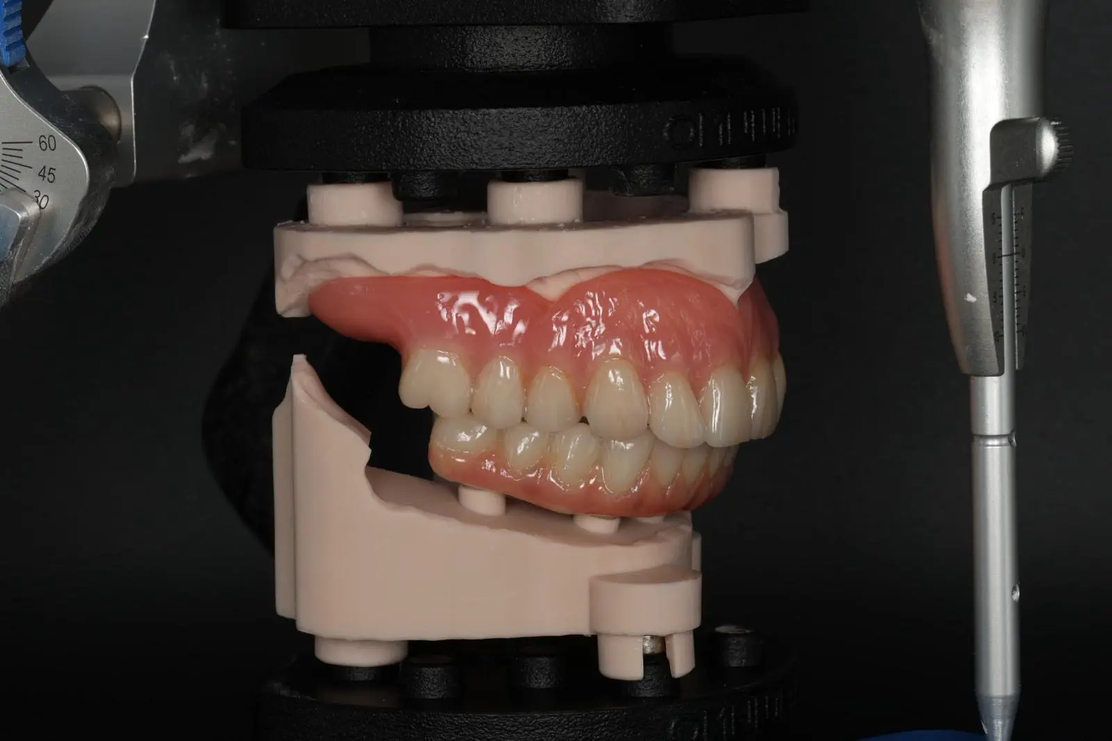 Full denture on DACOS Omni Ultra, right lateral view